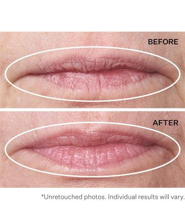 StriVectin Anti-Wrinkle Double Fix for Lips - Plump, Smooth Vertical Lines - Hydrating Treatment - Buy Online on GoSupps.com