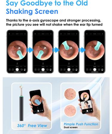 EARCLINA Ear Wax Removal Tool Kit - 1960P HD Ear Camera, WiFi Smart Cleaner for iPhone & Android - Black - Buy Online on GoSupps.com