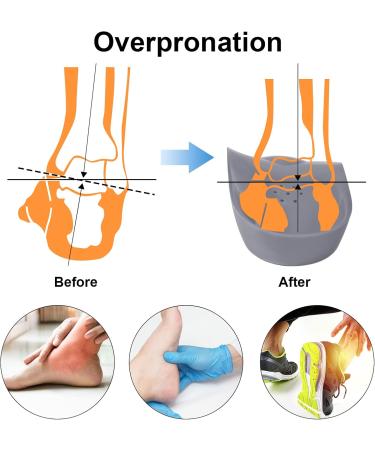 3/4 Original High Arch Orthotics Insoles for Plantar Fasciitis & Flat Feet - Firm Support Comfort Metatarsal Pads - Relief for Heel Spur Pain - Men 9-11/Women 10-12 - Gray - Buy Online on GoSupps.com