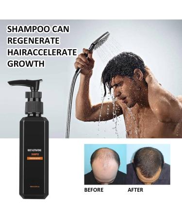  Aethryon hair growth shampoo root activating shampoo hair loss repair shampoo hair growth shampoo hair loss shampoo - Buy Online on GoSupps.com