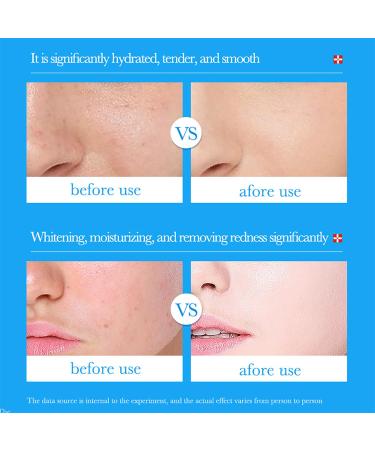 BIOAQUA Hyaluronic Acid & Vitamin B5 Face Essence - Soothing Moisturizing Skincare for Pore Reduction - 30ml/1fl.oz - Buy Online on GoSupps.com