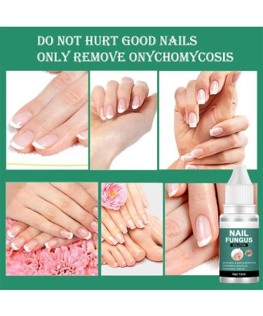 Extra Strong Fungal Nail Treatment for Toenails - Nail Repair Oil for Ingrown Nails - Strengthen and Renew Damaged Nails - 3Pcs Set - Buy Online on GoSupps.com