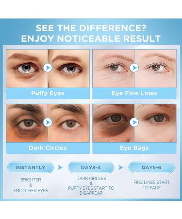 Arsh ge Under Eye Patches (30 Pairs) - 24K Gold Collagen Hyaluronic Eye Gel Pads for Dark Circles & Puffiness - Anti-Aging Eye Mask with Rose Extract - Reduce Wrinkles & Eye Bags - 12.30 Fl Oz - Buy Online on GoSupps.com