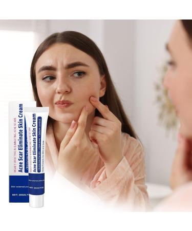  syayw Brufoli Cream - Suitable Cleansing Foam | Seborrheic Pimple Treatment | Brufoli Treatment for One Application | Multifunctional Cream for Pimples | Moisturizing Cream for Pimples - Buy Online on GoSupps.com