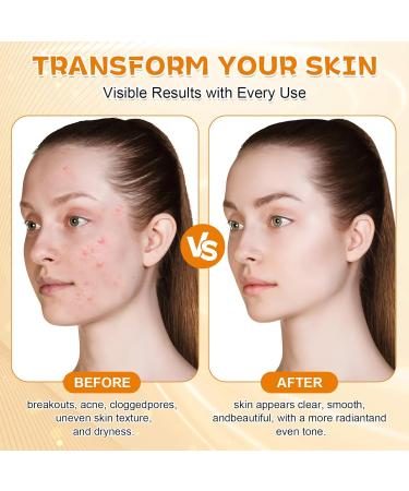 Yizemay Peel Shot Glow Rice Ampoule Duo peeling face with black and white rice gentle peeling & pore cleanser moisturizing blackhead remover for all skin types 1 piece 1er Pack - Buy Online on GoSupps.com