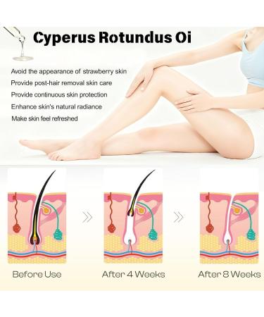 2PCS Cyperus Rotundus Oil -60ml Natural Cyperus Rotundus Oil is Used for Moisturizing and Soothing After Hair Removal. It Can Reduce Hair Growth on the Body and is Suitable For All Skin Types - Buy Online on GoSupps.com