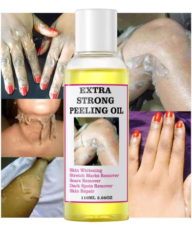 Yellow Peeling Oil Skin Peeling Exfoliator Skin Peeling Oil For Skin Lightening Peeling Oil For Skin Brightening Moisturizing Peeling Solution Exfoliatings Dark Skin For Body Lightening Bleaching 3* 110ml - Buy Online on GoSupps.com