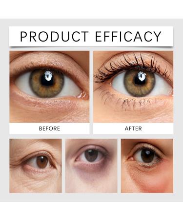 S rum hydratant et claircissant pour les yeux l'acide hyaluronique traitement anti- ge pour les yeux cr me anti-rides pour les cernes poches et poches sous les yeux r duit les ridules (6PCS) - Buy Online on GoSupps.com
