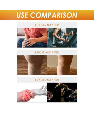 Beevital Apitoxin Treatment Gel - Joint and Bone Therapy | Professional Bee Venom Cream for Pain Relief (3pcs) - Buy Online on GoSupps.com