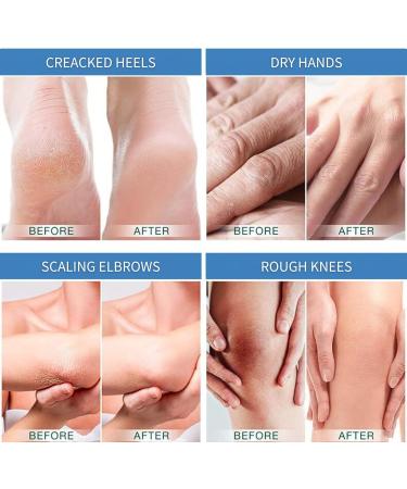 TBeautfave Moisturising Solid Hand Cream Stick Anti Cracking Care Cream Cracked Heel Repair Cream Moisturizing Cream For Dry Cracked Feet Hands Elbows No Sticky Residue Orange Scent 40g - Buy Online on GoSupps.com