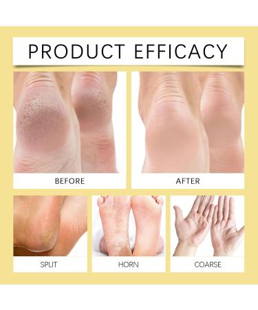 2025 Cr me pour les pieds tr s secs hydratante et anti-fissures cr me de soin des pieds l'ur e pour les peaux rugueuses s ches paisses et gerc es - Buy Online on GoSupps.com