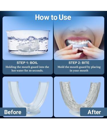 Custom Night Guard for Teeth Grinding | Anti-Bruxism Mouth Guard - Black | International Shipping - Buy Online on GoSupps.com