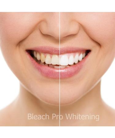 10% Carbamide Peroxide Teeth Whitening Gel - 10 pc Tooth Bleaching Dispensers - Buy Online on GoSupps.com