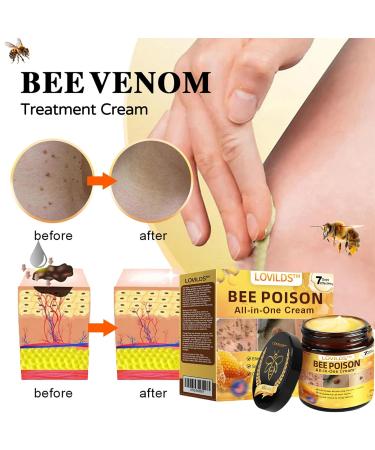 LOVILDS Bee Poison All-in-One Cream lovlids bee poisoning all in one cream Bee Venom Skin Treatment Cream Effectively reduces skin blemishes(1PC) - Buy Online on GoSupps.com