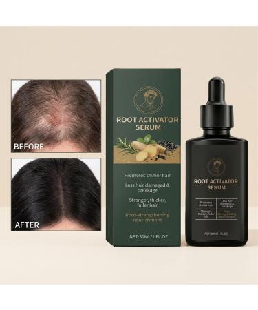 Solution paississante pour cheveux formule non grasse pour cuir chevelu solution amincissante avec m ches de cheveux volume de soutien de la croissance des cheveux soin quotidien du cuir chevelu - Buy Online on GoSupps.com