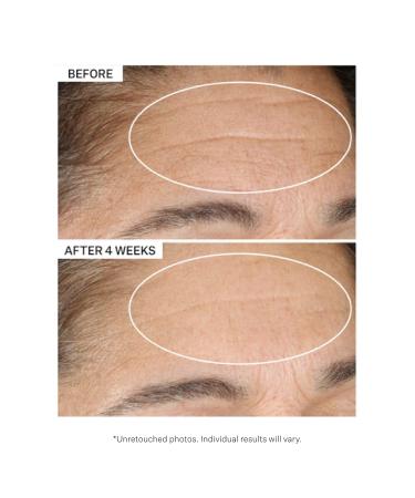 StriVectin Advanced Retinol Serum & Moisturizer for Fine Lines - 1.1 oz - Buy Online on GoSupps.com