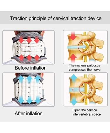 SSDDDLZEQ Neck Support - Cervical Neck Traction Device for Spine Alignment at Home | 360 Fixed Winding Airbag Compression Multidimensional Traction (Color: Rosso) - Buy Online on GoSupps.com