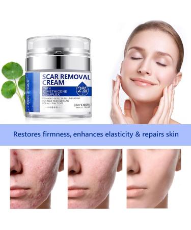 Scar Removal Cream - Natural Scar Repair for Acne Stretch Marks & More | Effective for Old & New Scars on Face & Body - Buy Online on GoSupps.com