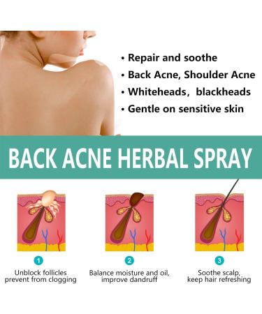 Back Acne Treatment Spray Back & Body Acne Treatment Acne Body Spray Tea Tree Oil for Skin Smooth Moisturiser for Acne Prone Skin Acne Moisturiser Gentle Repair Back Shoulder/Body /Chest /Butt - Buy Online on GoSupps.com