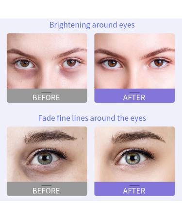 HOUSN Eye Cream Eye Cream Anti-aging Eye Cream Anti-Wrinkle Eye Contour Cream 20ml Anti-dark circles Anti-puffiness Wrinkles Firmness for luminous and plump skin under the eyes - Buy Online on GoSupps.com