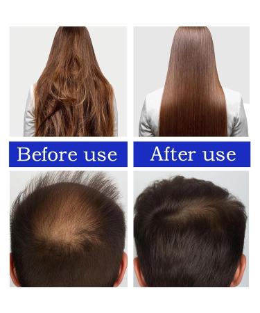 100% Pure Batana Oil for Hair Growth - Organic Raw Miracle Oil from Honduras | Repairs Damaged Hair & Restores Shine - 120g - Buy Online on GoSupps.com