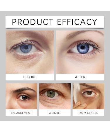 Lumibalm Eye Stick for Bags Under Eyes Retinol Eye Stick Eye Cream for Dark Circles Moisturizing Eye Stick to Reduce Wrinkles and Fine Lines (4 pcs) - Buy Online on GoSupps.com