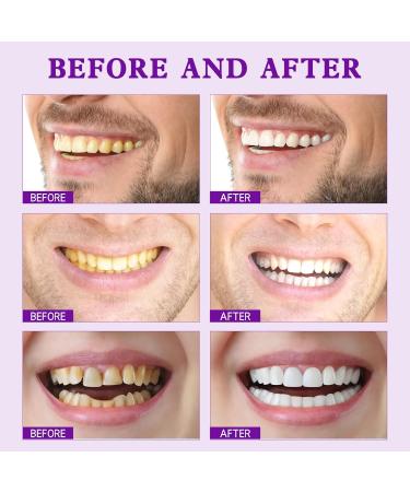 SP-7 Probiotic Whitening Toothpaste | Natural Teeth Whitener for Deep Cleaning Stain Removal & Fresh Breath - Complete Oral Care (1PC) - Buy Online on GoSupps.com