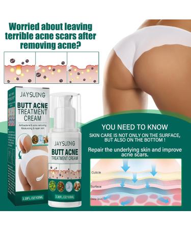 OLLZPJFPK Butt Care Cream Refreshing Texture Moisturizing Gentle Ingredients Comfortable Care Butt Acne Body Cream - Buy Online on GoSupps.com