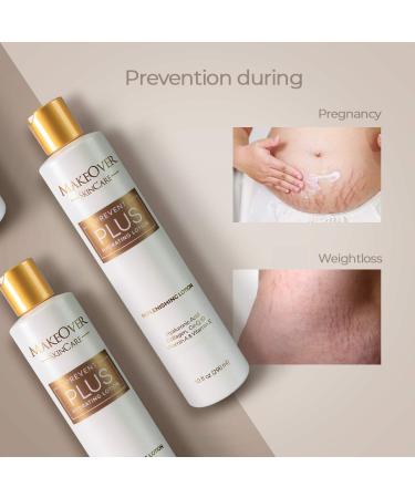MakeOver SkinCare Prevent Plus Hydrating Lotion - Stretch Marks & Scar Prevention with Vitamin A E CoQ10 Hyaluronic Acid & Collagen - 1.0 Fl Oz - Buy Online on GoSupps.com