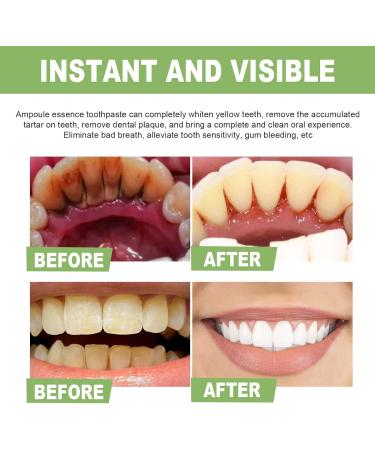 TLOPA Ampoule Toothpaste TLOPA Ampoule Tooth Serum 3v Fruit Acid Teeth Whitening Disposable Essence Ampoule Whitening Essence Whitening Toothpaste Disposable for Sensitive Removal Tartar Plaque (2pcs) - Buy Online on GoSupps.com