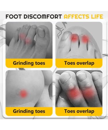10PCS Silicone Anti-Friction Toe Protectors - 2023 New Breathable Covers for Men and Women - Buy Online on GoSupps.com