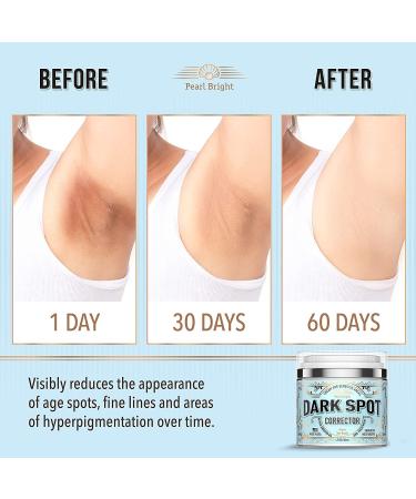PearlBright Dark Spot Remover for Face & Body - Natural Skincare for Sensitive Areas - Made in USA - With Licorice, Mulberry Extract, Arbutin - 1.7oz - Buy Online on GoSupps.com