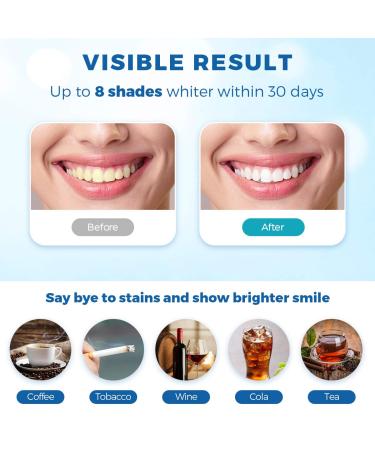 SINORIKO Teeth Whitening Kit - 6X LED Light, Fast 10 Min Results, 3 Whitening Gels, Remineralizing Gel, Home Teeth Whitener - Buy Online on GoSupps.com