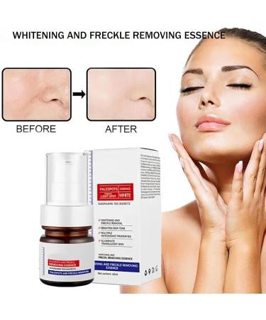 Whitening and Freckle Removing Essence | 30ml Magic Whitening Spots Cream | Vitamin C Blemish Serum for Melasma Melanosis Acne Scar (1PC) - Buy Online on GoSupps.com