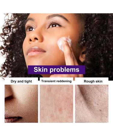 Hyaluronic Acid Face Cream Moisturiser Face Moisturizer for Women Essence Face Cream Moisturiser Face Women Reduce Redness & Dryness For Body & Hands Non-Greasy For Sensitive & Very Dry Skin - Buy Online on GoSupps.com