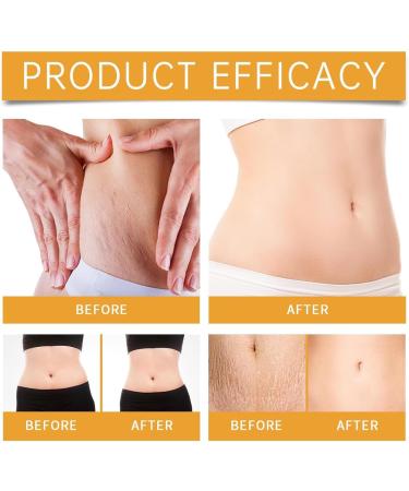 Anti-Stretch Mark Cream Belly Firming Cream Natural Organic Products Moisturizing and Nourishing Smooth Skin - Buy Online on GoSupps.com