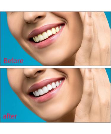 Press Tooth Veneers - 2 Pairs of Cosmetic False Teeth for a Perfect Smile | Repair Your Teeth & Enhance Your Confidence - Buy Online on GoSupps.com