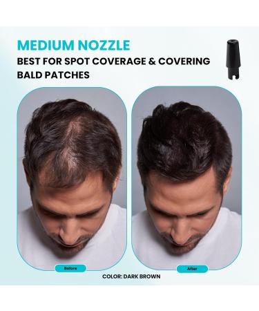 SureThik Hair Thickening Fiber Starter Package - Includes Medium Brown Fiber Holding Spray & Application Tools - Perfect for Instant Volume & Coverage - Buy Online on GoSupps.com