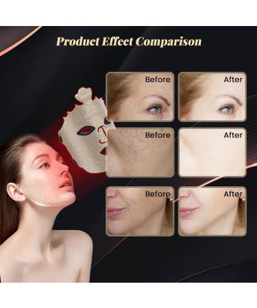 Red Light Therapy Mask - Wireless 7 Color LED Face Mask for Anti-Aging & Skin Care - Buy Online on GoSupps.com