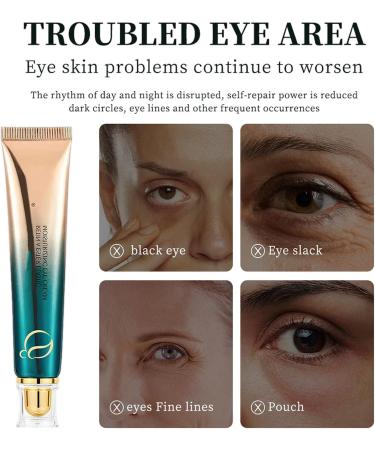 Retinol Eye Cream Anti Aging Under Repair Eyecream for Dark Circles and Puffy Eyes Moisturising Anti-Wrinkle Eye Creams Under Eye Enhancer Brightener Eyes Bags Remover - Buy Online on GoSupps.com