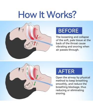 Taoscare Anti Snoring Devices Snoring Solution for Men and Women Silicone Magnetic Nose Clip Effective Hale Breathing Aid Stop Snoring Aids to Snooze Sleep (10 Pack) - Buy Online on GoSupps.com