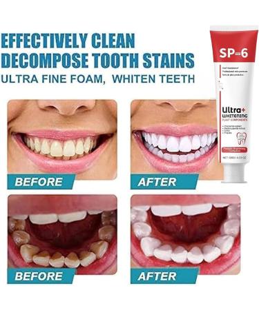 SP-6 Probiotic Toothpaste for Lightening & Stain Removal - 3PC Brightening Formula for Deep Cleaning & Fresh Breath - Buy Online on GoSupps.com