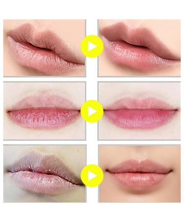 Balm Lip Balm Pot Moisturizing Lip Reduces Lip Lines Prevention Dry And Lip Exfoliator. Lip Plumper Lip Gloss (Yellow One Size) 1 count (Pack of 1) Yellow - Buy Online on GoSupps.com