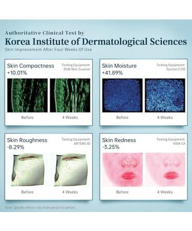 GYH Led Face Mask Light Therapy  Red Light Therapy for Face  FSA/HSA Eligible  Wireless High Dose Red  Infrared & Blue Light Therapy Mask for Skin Care  Anti-ageing Cloud-S (RB-014) - Buy Online on GoSupps.com