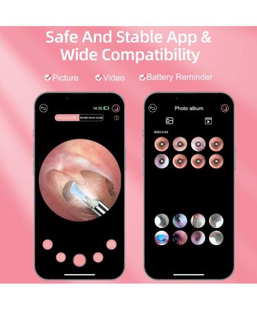Premium Ear Wax Removal Kit with 1080P Camera - Otoscope & Ear Cleaning Tool for iPhone iPad Android (Pink - Buy Online on GoSupps.com