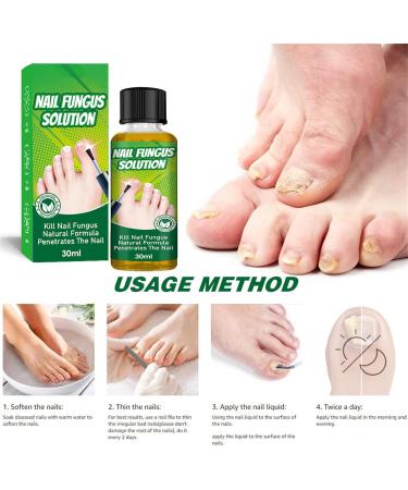 ERFD Toenail fungus care Fungal Nail Cure for Toenails Extra Strong 30ml Anti Fungal Toe Nails Treatment - Buy Online on GoSupps.com