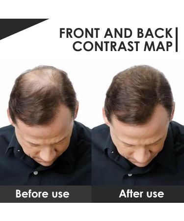 Buy Spread Hair for Thinning & Receding Hair - Instant Volume & Density 27.5g (Black) - Best Hair Loss Solution - Buy Online on GoSupps.com