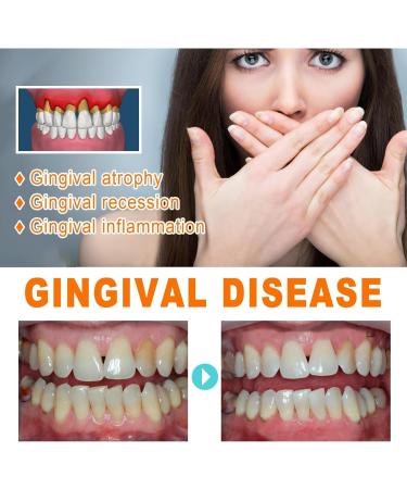 Gum Repair Treatment Ampoules Gum Repair Treatment Ampoules Oral And Gingival Care Essence For Removing Tartar Teeth Repair Protect Gums (2pcs) - Buy Online on GoSupps.com