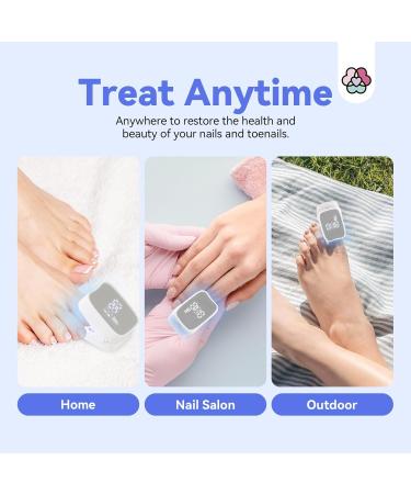 SAVILAND Nail Fungus Cleaning Device Faster: Max-Effective 905nm Infrared Light 470nm Blue Light Defeat Fungi Nail Fingernail Fungus Toenail Fungus Safer Painless Rechargeable Fungi Cure Home Use - Buy Online on GoSupps.com