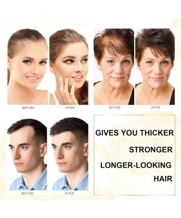 Rice Water Hair Growth Shampoo | Biotin & Rosemary Oil for Hair Loss | Natural Thickening Shampoo for All Hair Types - 10 Fl Oz - Buy Online on GoSupps.com